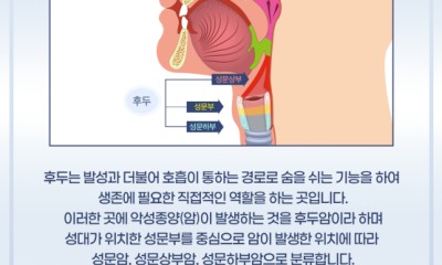 땡큐서울의원 - [성명훈 원장] 후두암, 적절한 검사 방법 및 시기는?