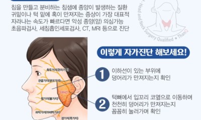 땡큐서울의원 - [강영 원장] 턱 밑에 생긴 혹, 침샘 종양이라면 양성이라도 제거!