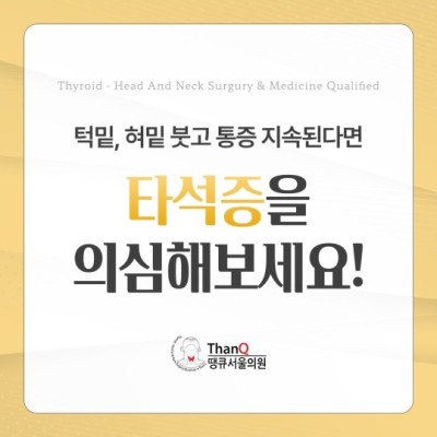 땡큐서울의원 - 타석증