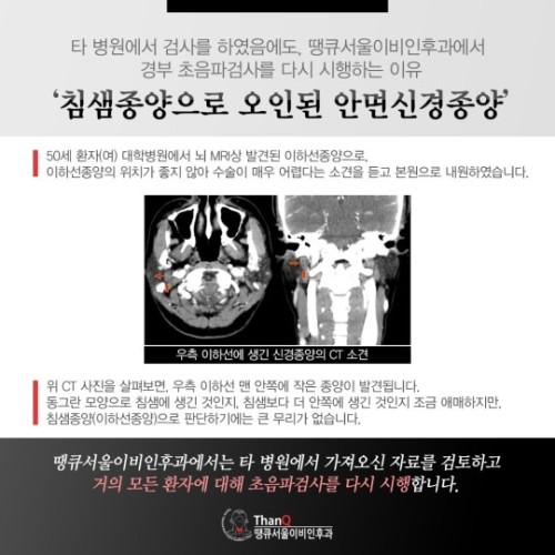 땡큐서울의원 - 안면신경종양