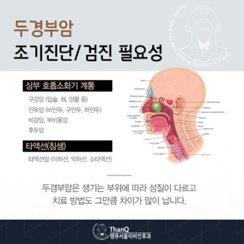 땡큐서울의원 - 두경부암 조기진단필요성