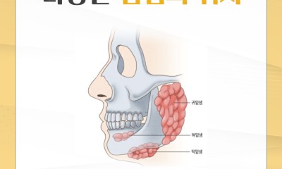 땡큐서울의원 - [신현일 원장] 식사 때마다 턱밑이 붓고 아프다면? 침샘 길을 막는 ‘타석증’의 신호다