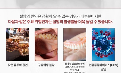 땡큐서울의원 - [하정훈 원장] 혀 백반증과 혀 종양, 설암일 수 있다