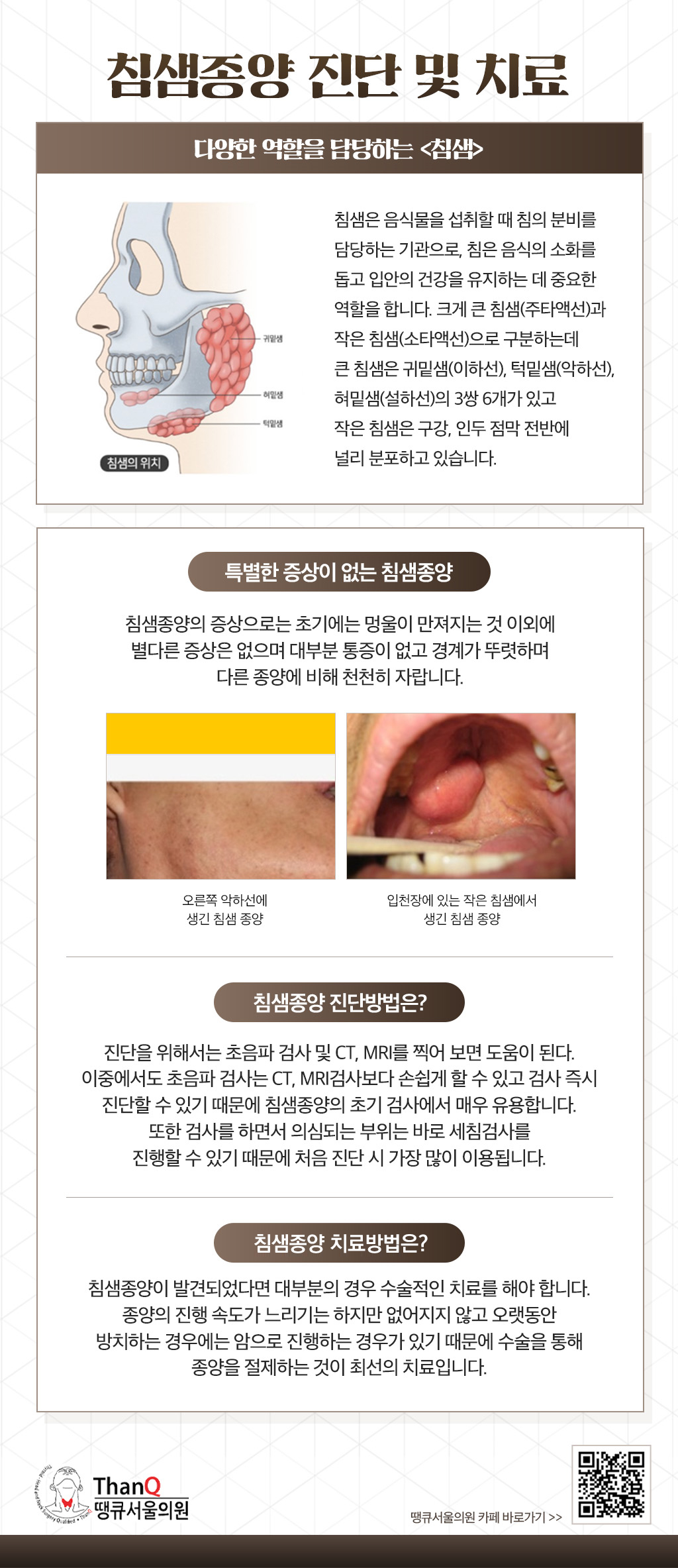 땡큐서울의원 - [땡큐서울의원 갑상선클리닉 _ 하정훈 원장 의학칼럼] 침샘 종양 수술, '안면신경 손상' 최소화가 중요한 이유