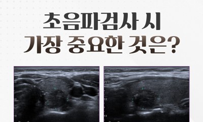 땡큐서울의원 - [땡큐서울의원 갑상선클리닉 _ 이은정 원장 의학칼럼] 갑상선 초음파 검사로 알 수 있는 것