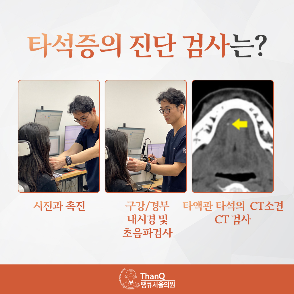 땡큐서울의원 - [땡큐서울의원 침샘클리닉 _ 강영 원장 의학칼럼] 식사할 때마다 반복되는 턱밑 부종, '타석증'을 의심하라
