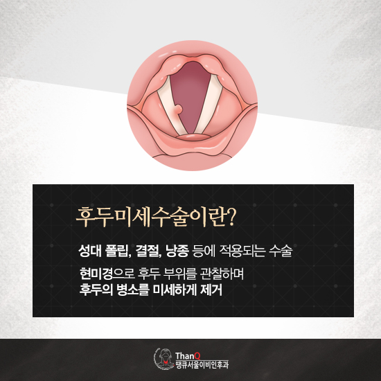 땡큐서울의원 - [땡큐서울의원 갑상선클리닉 _ 강영 원장 의학칼럼] 후두미세수술이 필요한 성대질환, 언제 고려해야 할까?