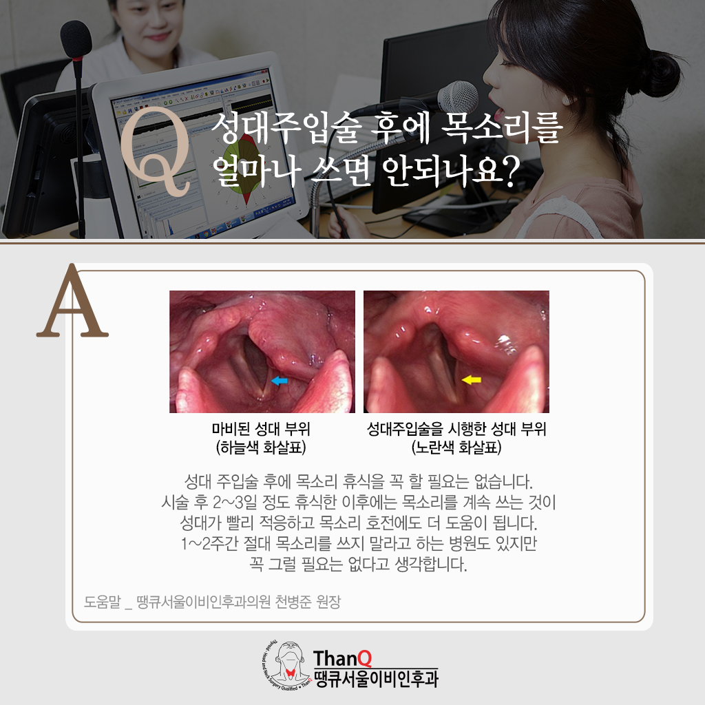 땡큐서울의원 - [땡큐서울의원 음성클리닉_ 성명훈 원장 의학칼럼] 쉰 목소리 방치하면 굳은살로, 성대결절의 증상과 치료