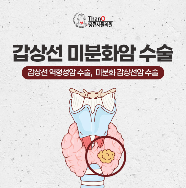 땡큐서울의원 - 갑상선 미분화암 수술(갑상선 역형성암 수술, 미분화 갑상선암 수술)