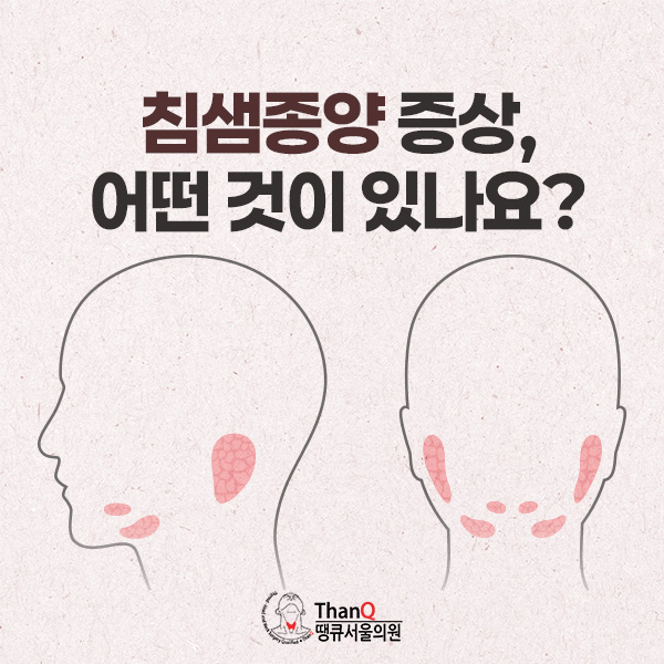 땡큐서울의원 - 침샘종양 증상, 어떤 것이 있나요?