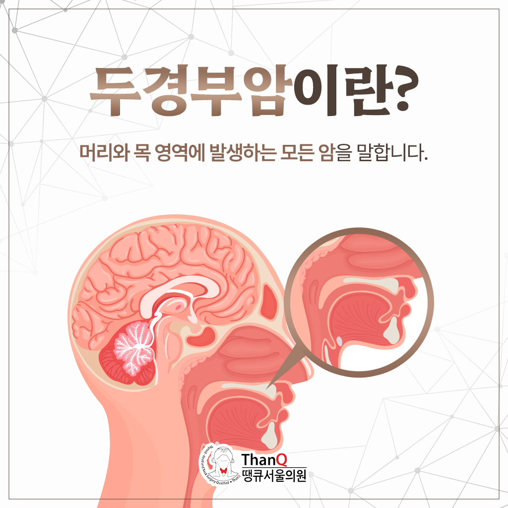 땡큐서울의원 - [땡큐서울의원 두경부클리닉 _ 성명훈 원장 의학칼럼] 감기·구내염과 헷갈리기 쉬운 두경부암, 조기 진단과 검사의 모든 것