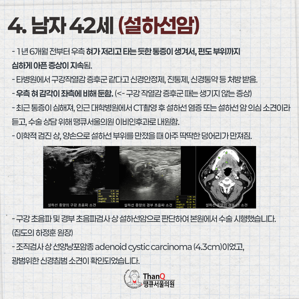 땡큐서울의원 - 땡큐서울의원의 침샘암 사례