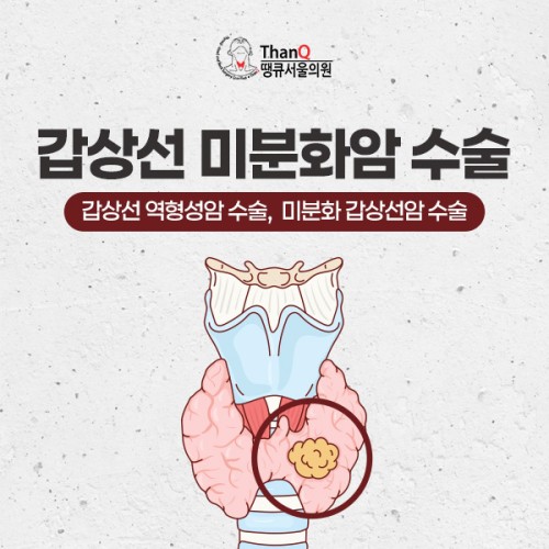땡큐서울의원 - 갑상선 미분화암 수술(갑상선 역형성암 수술, 미분화 갑상선암 수술)