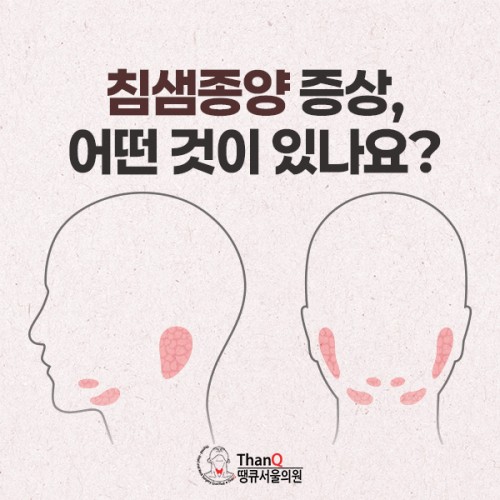 땡큐서울의원 - 침샘종양 증상, 어떤 것이 있나요?