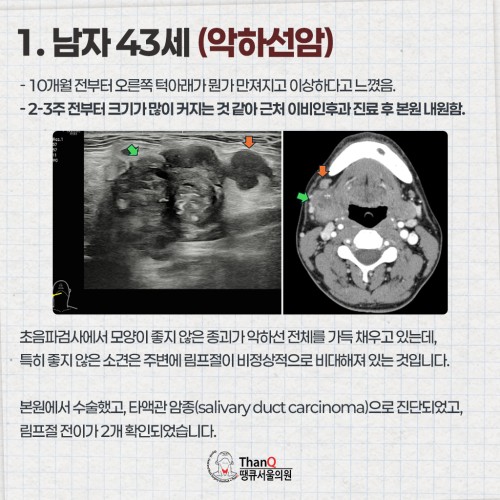 땡큐서울의원 - 땡큐서울의원의 침샘암 사례