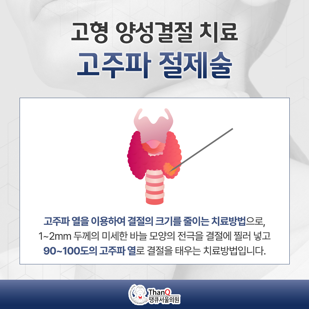 땡큐서울의원 - [땡큐서울의원 갑상선클리닉_ 강영 원장 의학칼럼] 갑상선 양성결절, 꼭 수술해야 할까? 고주파 치료가 필요한 경우