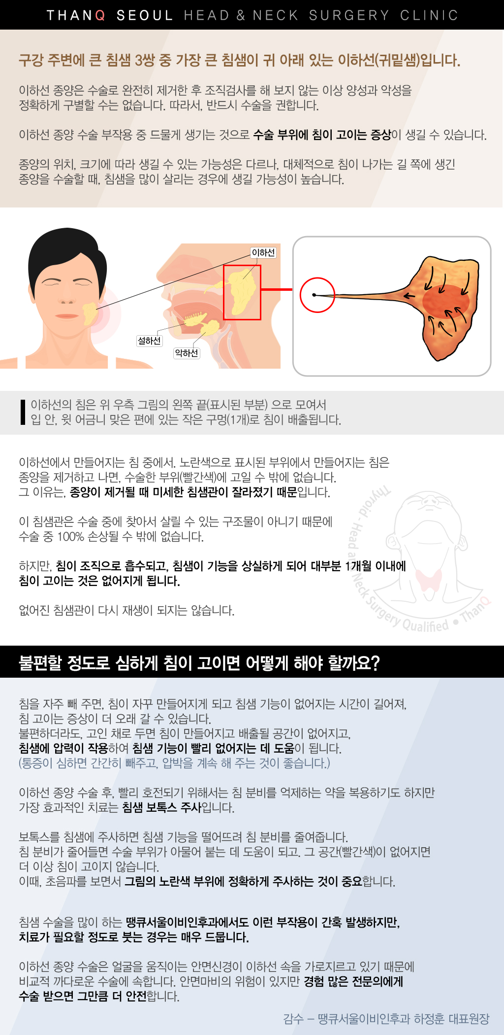 땡큐서울의원 - [땡큐서울의원 이하선종양클리닉_ 하정훈 원장 의학칼럼] 귀밑에 생긴 이하선종양, 수술에서 안면신경 보존이 중요한 이유
