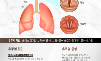 땡큐서울의원 - 쉰 목소리가 2주 이상 계속된다면 무엇을 확인해야 할까