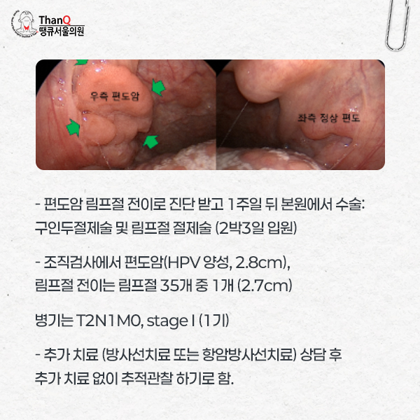땡큐서울의원 - 땡큐서울의원 편도암 수술 4인 4색
