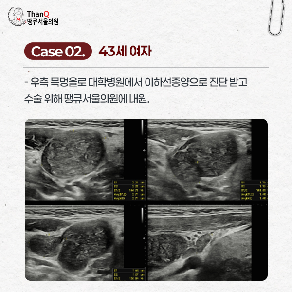 땡큐서울의원 - 땡큐서울의원 편도암 수술 4인 4색