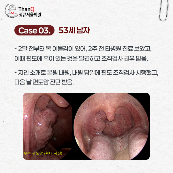 땡큐서울의원 - 땡큐서울의원 편도암 수술 4인 4색