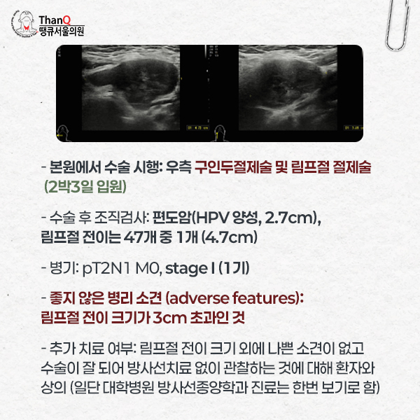 땡큐서울의원 - 땡큐서울의원 편도암 수술 4인 4색