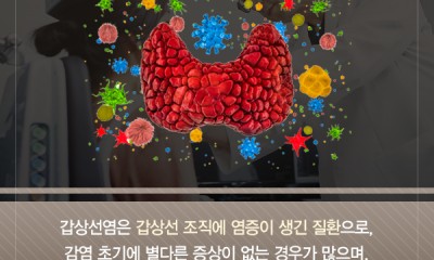 땡큐서울의원 - [땡큐서울의원 갑상선클리닉_ 송영기 원장 의학칼럼] 갑상선염 증상, 유형에 따라 달라져… 놓쳐서는 안 되는 이상 신호는?